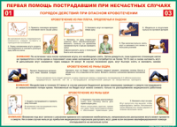 Таблица Порядок действий при опасном кровотечении 1000*1400 винил - «globural.ru» - Воткинск